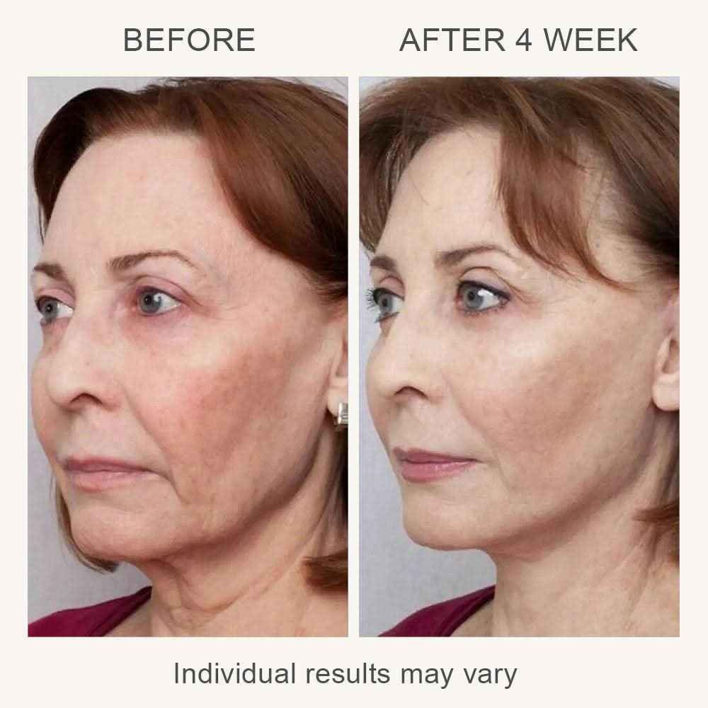 VIA 3-in-1 Skin Rejuvenation Device