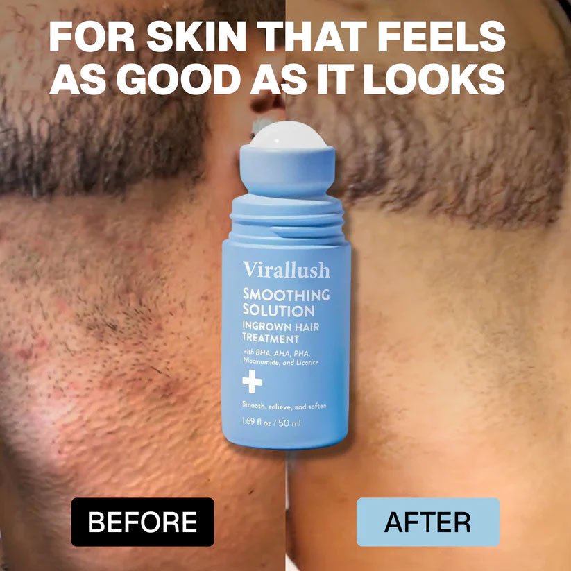 ViralLush: Smoothing Solution For Ingrown Hairs