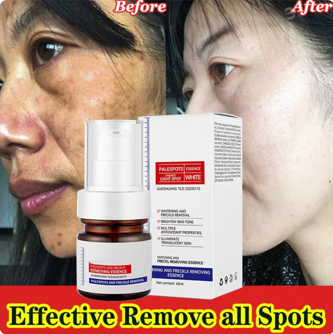 Vitamin C Whitening Freckles ESSENCE: Fade Dark Spots, Melasma, and Achieve Your Flawless.