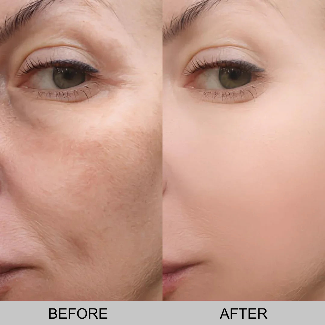 Feline Skinscience Rice Ampoule Duo: The End of Pore Problems. Period.