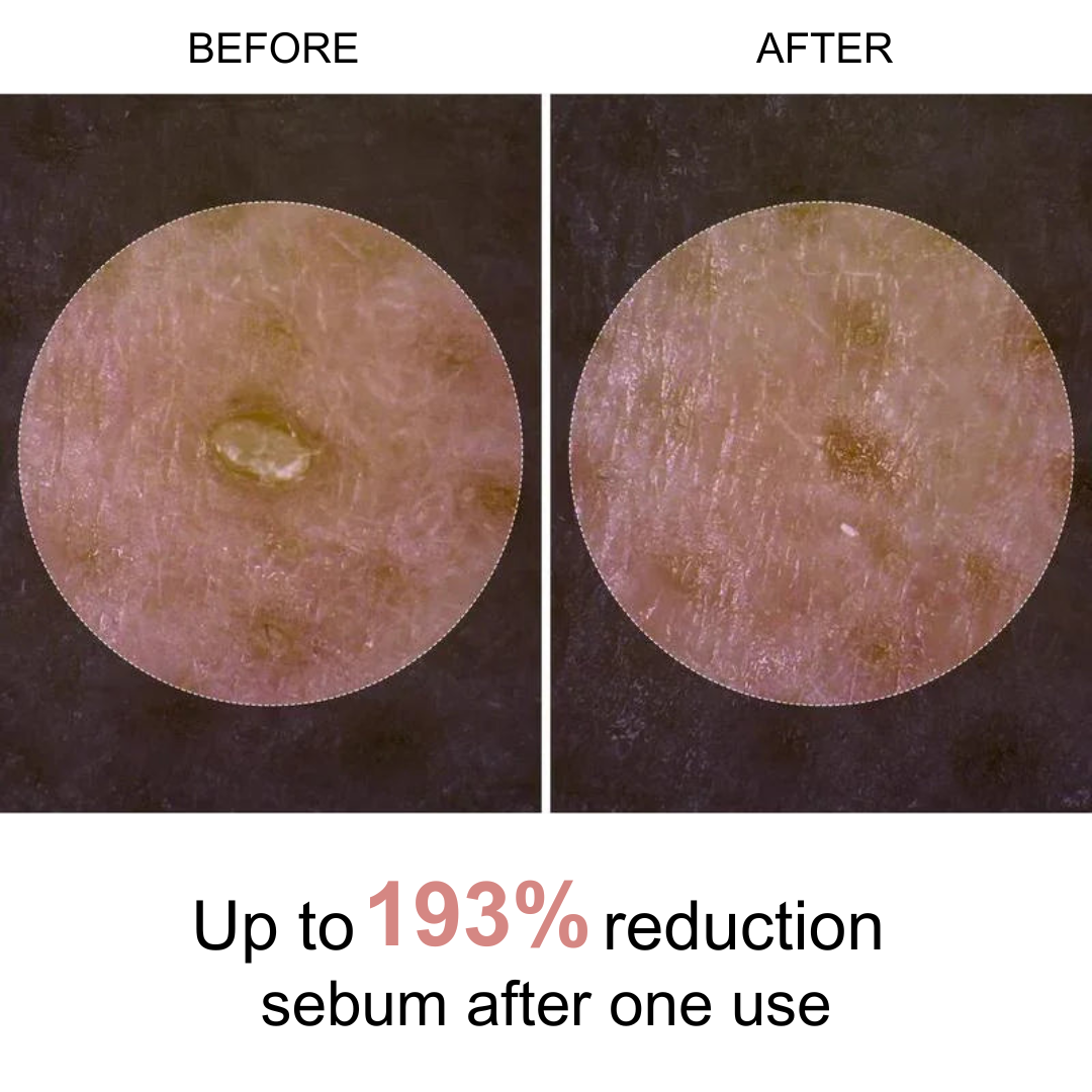 Feline Skinscience Rice Ampoule Duo: The End of Pore Problems. Period.