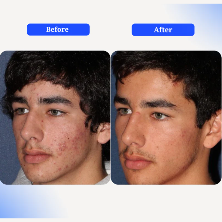 💙 Revivra Copper Tripeptide-1 Serum: Unlock Your Skin's "Rebuild and Restore" System