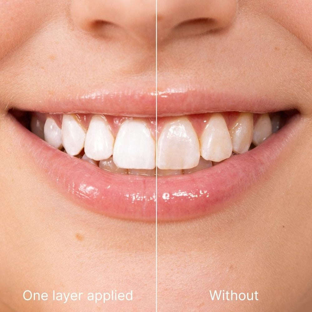 Teeth Polish: Get Instantly White Teeth for Any Occasion!