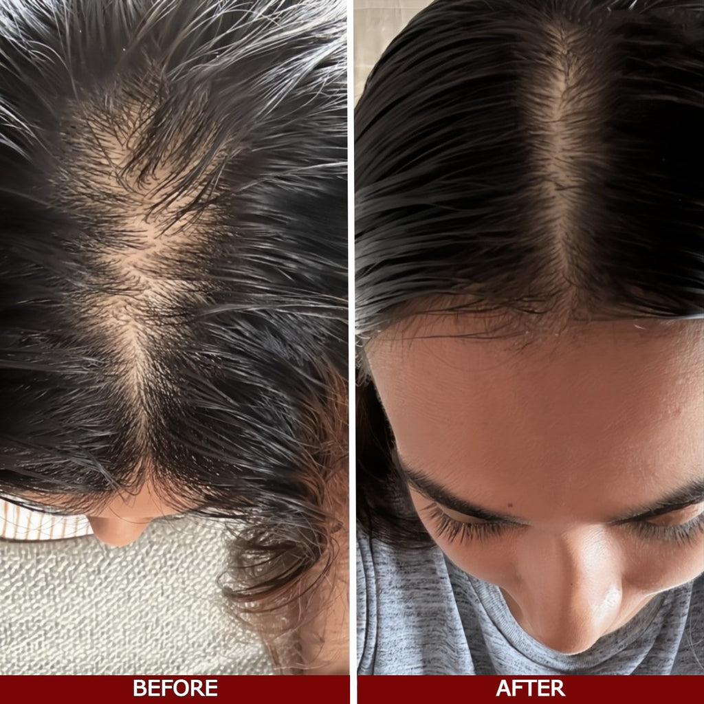 LOVILDS™ Advanced Hair Growth Serum