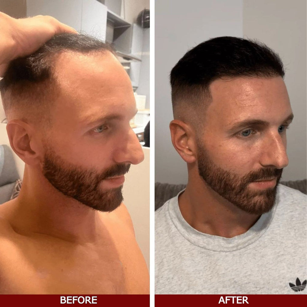 LOVILDS™ Advanced Hair Growth Serum