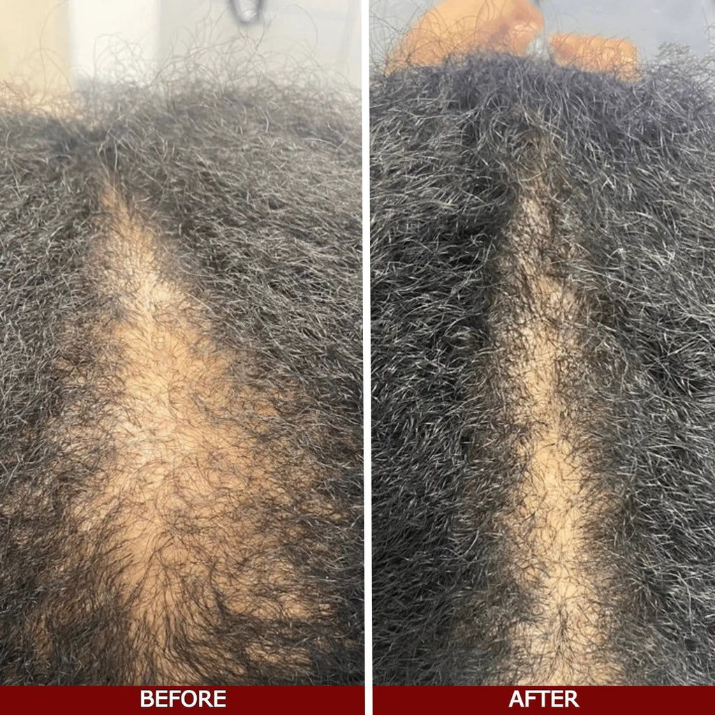 LOVILDS™ Advanced Hair Growth Serum