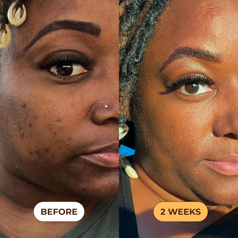 GLO Melanin Turmeric Scrub: Reveal Your Natural Radiance