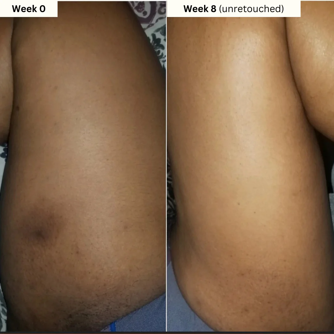 Kojic Acid 4-in-1 Brightening Soap - Unveil Your Brightest Skin. The Natural 4-in-1 Secret to Radiant Glow.