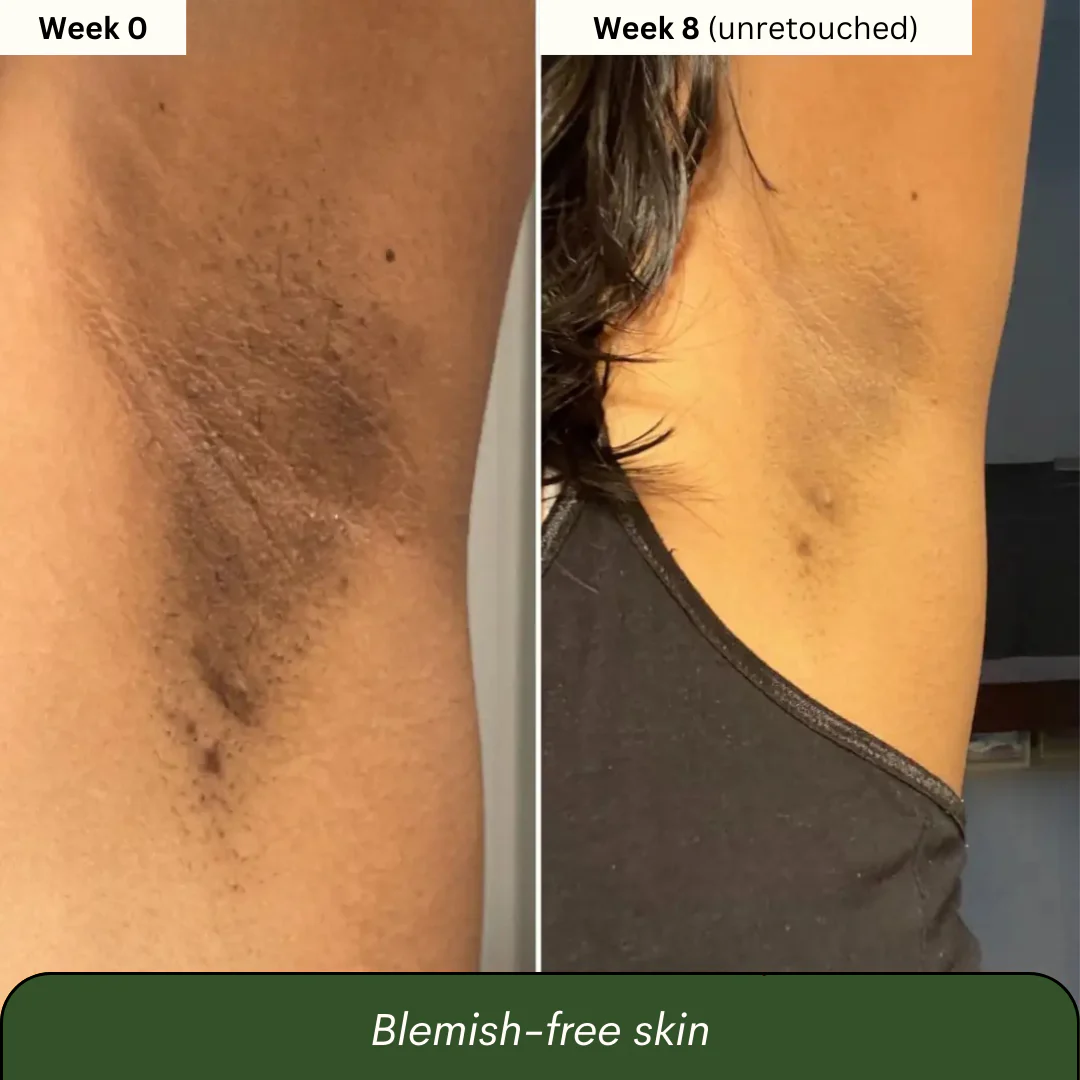 Kojic Acid 4-in-1 Brightening Soap - Unveil Your Brightest Skin. The Natural 4-in-1 Secret to Radiant Glow.