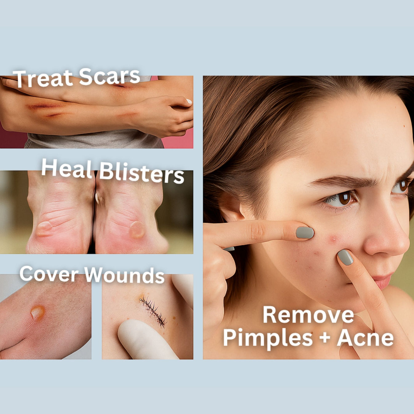 HydroClear™ Medical-Grade Hydrocolloid Roll